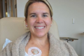 A mom’s Stage IV cancer had no symptoms. An innovative surgery saved her life.