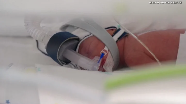 Australian woman gives birth to rare identical quadruplet daughters