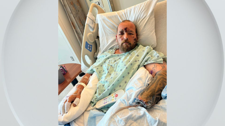 Man loses hand after explosion on California beach while picking up debris, family says
